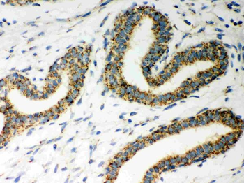 Anti-ERAB/HSD17B10 Antibody