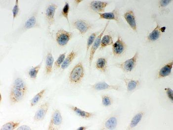 Anti-LYRIC/MTDH Antibody