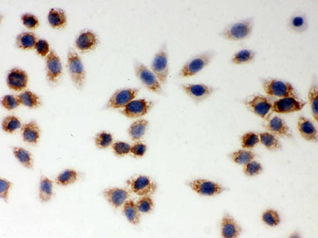 Anti-LYRIC/MTDH Antibody