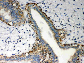 Anti-LYRIC/MTDH Antibody
