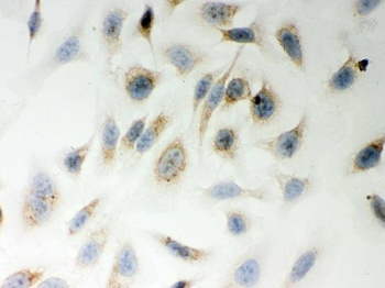 LYRIC/MTDH Antibody