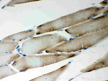 Anti-LYRIC/MTDH Antibody