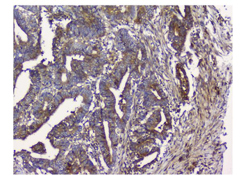 Anti-N myc interactor/NMI Antibody