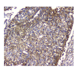 Anti-N myc interactor/NMI Antibody