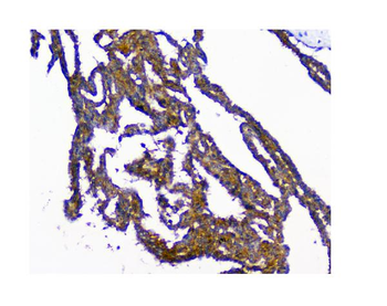 Anti-N myc interactor/NMI Antibody