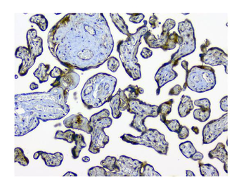 Anti-N myc interactor/NMI Antibody