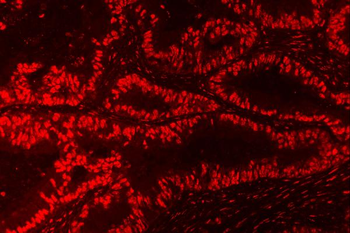 Anti-Nucleophosmin/NPM1 Antibody