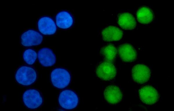 Anti-Nucleophosmin/NPM1 Antibody