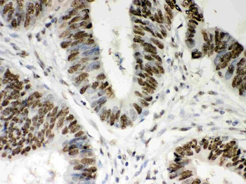 Anti-Nucleophosmin/NPM1 Antibody