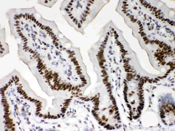 Nucleophosmin/NPM1 Antibody