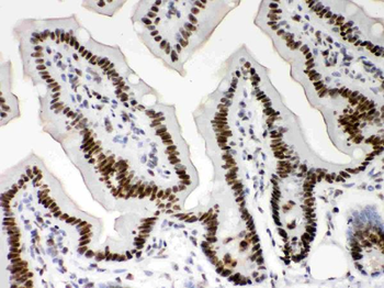 Anti-Nucleophosmin/NPM1 Antibody