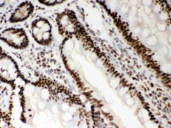 Anti-Nucleophosmin/NPM1 Antibody