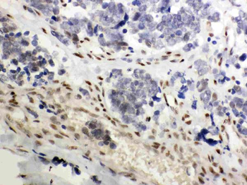 Anti-Glucocorticoid Receptor/NR3C1 Antibody