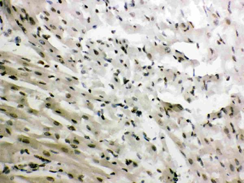 Anti-Glucocorticoid Receptor/NR3C1 Antibody