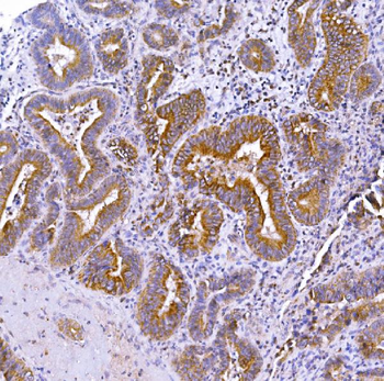 Anti-Optineurin/OPTN Antibody