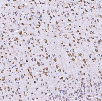 Anti-Optineurin/OPTN Antibody