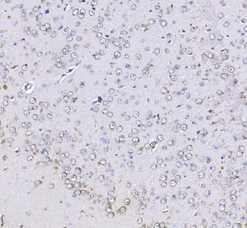 Anti-Optineurin/OPTN Antibody