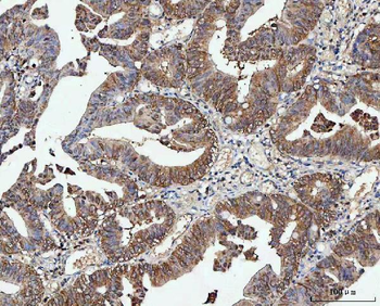 Anti-PP2A-alpha/PPP2CA Antibody