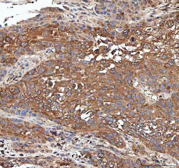 Anti-PP2A-alpha/PPP2CA Antibody