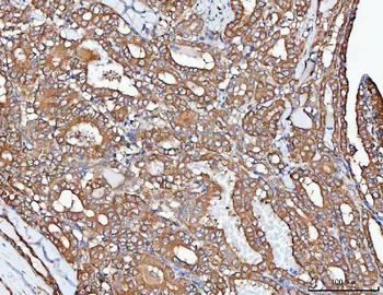 Anti-PP2A-alpha/PPP2CA Antibody