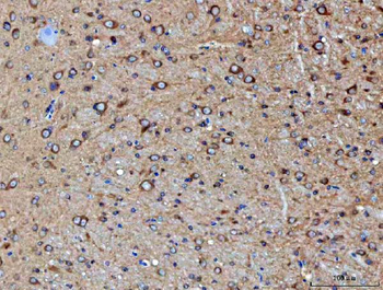 Anti-PP2A-alpha/PPP2CA Antibody