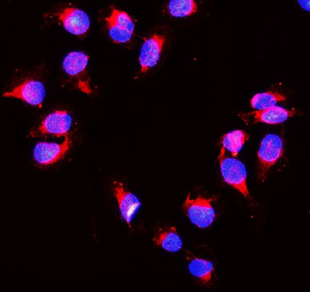 Anti-Peroxiredoxin 1/PRDX1 Antibody
