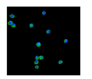 Anti-Peroxiredoxin 1/PRDX1 Antibody