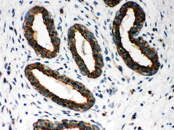 Anti-Peroxiredoxin 1/PRDX1 Antibody