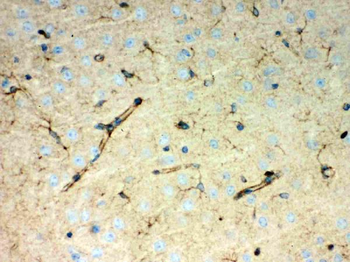 Anti-Peroxiredoxin 1/PRDX1 Antibody