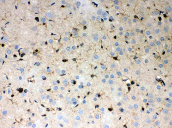 Anti-Peroxiredoxin 1/PRDX1 Antibody