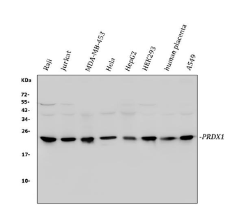 Anti-Peroxiredoxin 1/PRDX1 Antibody