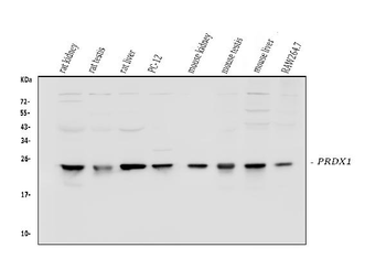 Anti-Peroxiredoxin 1/PRDX1 Antibody