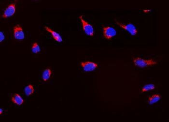 Anti-Peroxiredoxin 3/PRDX3 Antibody