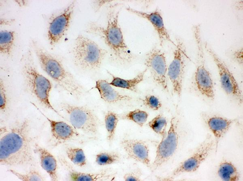 Anti-Peroxiredoxin 3/PRDX3 Antibody