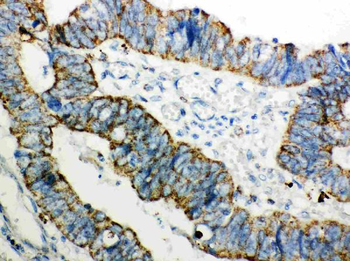 Anti-Peroxiredoxin 3/PRDX3 Antibody
