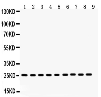Anti-Peroxiredoxin 3/PRDX3 Antibody