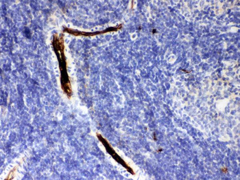 Anti-alpha 1 Antitrypsin/SERPINA1 Antibody