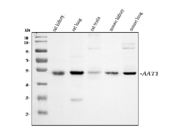 Anti-alpha 1 Antitrypsin/SERPINA1 Antibody