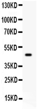 SerpinB2 Antibody