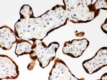 SerpinB2 Antibody
