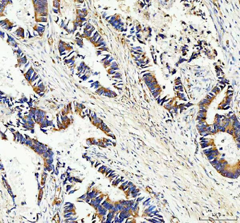 Anti-MASPIN/SERPINB5 Antibody