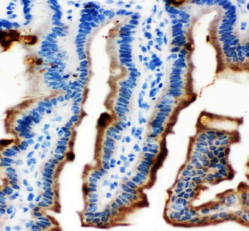 Anti-MASPIN/SERPINB5 Antibody