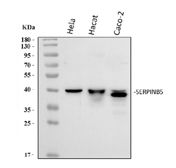 Anti-MASPIN/SERPINB5 Antibody