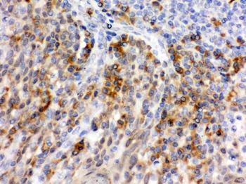 Anti-CD62P/SELP Antibody