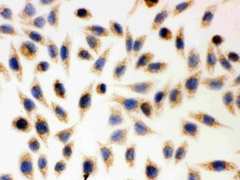 Anti-AIF/AIFM1 Antibody