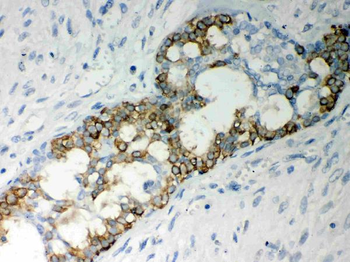 Anti-Caspase-7/CASP7 Antibody
