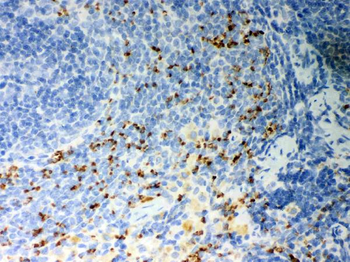 CD36 Antibody
