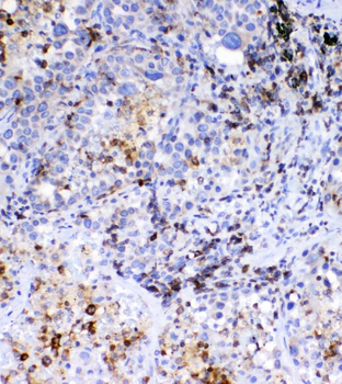 CD36 Antibody