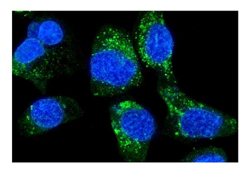 HLA A/HLA-A Rabbit Polyclonal Antibody