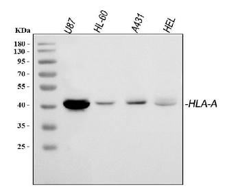 Anti-HLA A/HLA-A Antibody